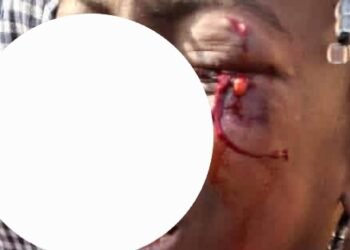 Blessée lors des tensions à Bailobaya : L’identité de la fillette enfin connue