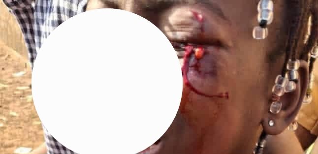 Blessée lors des tensions à Bailobaya : L’identité de la fillette enfin connue