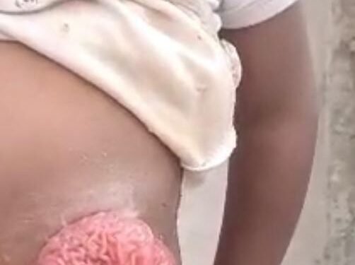 Destination Belgique : Une course contre la montre pour sauver un enfant